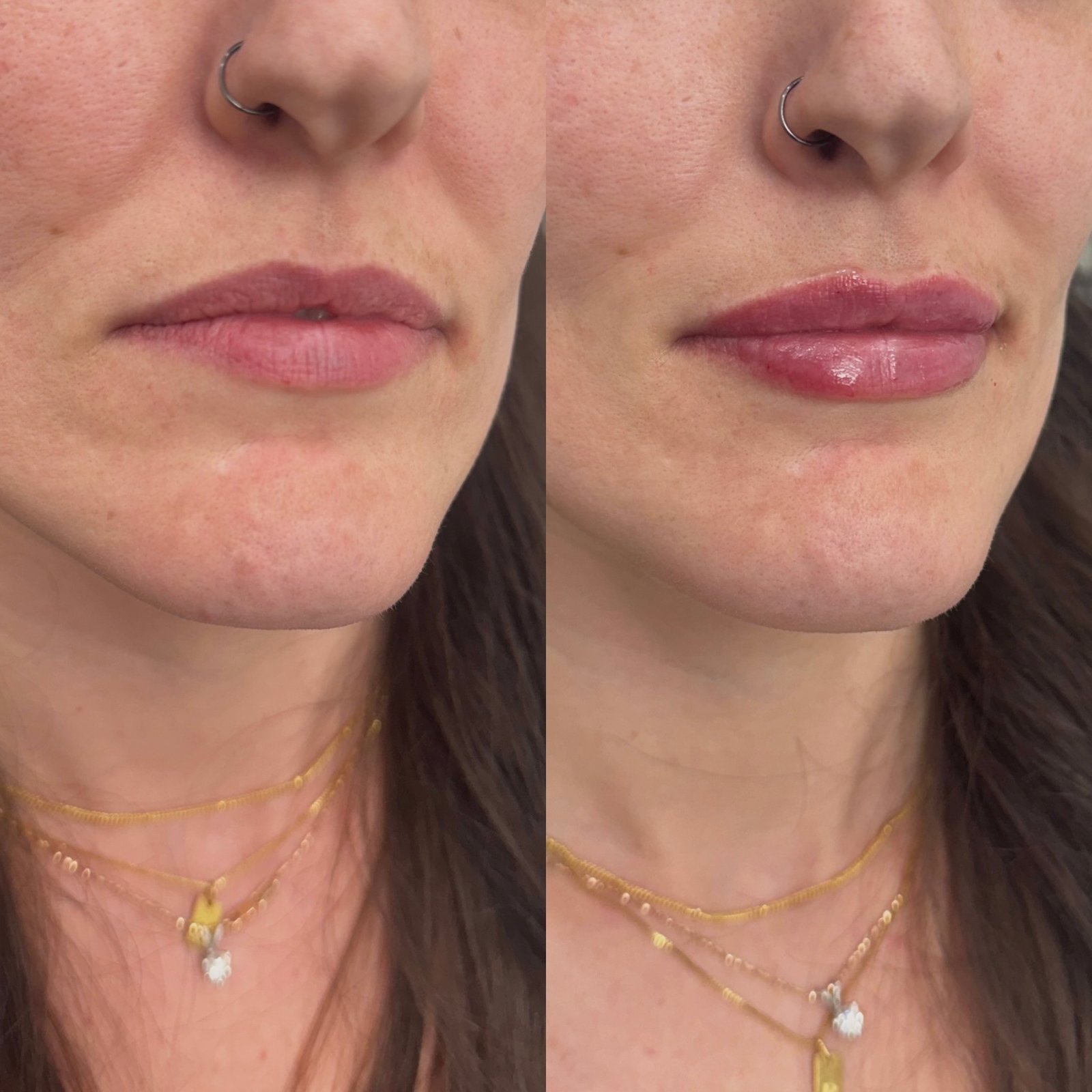 1D6CCAB6-4D30-4BE0-A1AE-6575AD214FC7