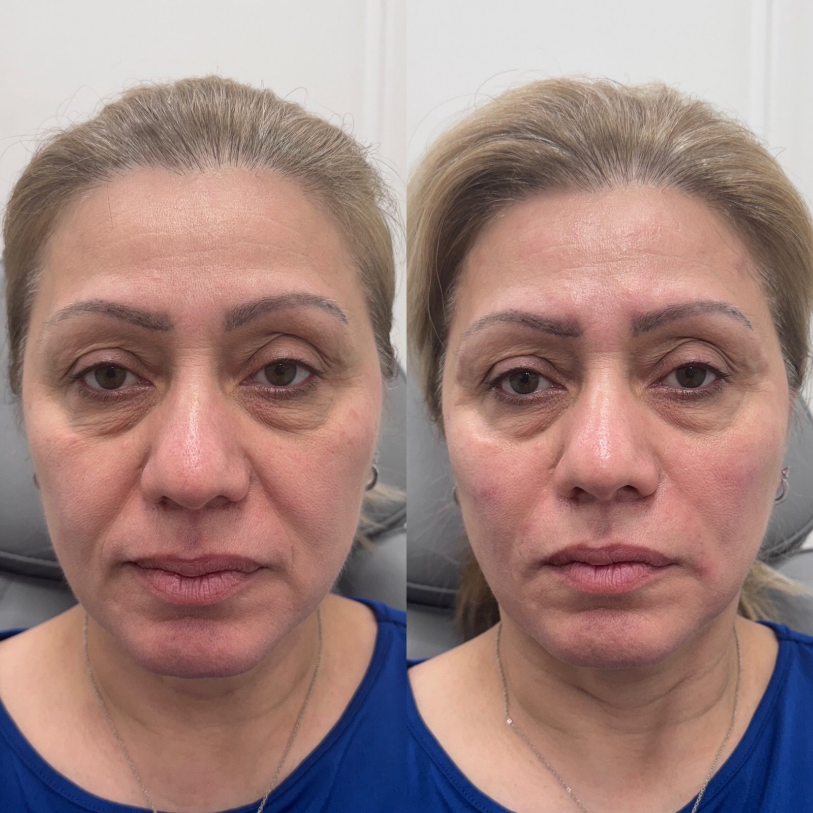 7ED1A09C-FBAE-4E47-B71B-EF0766006CFB