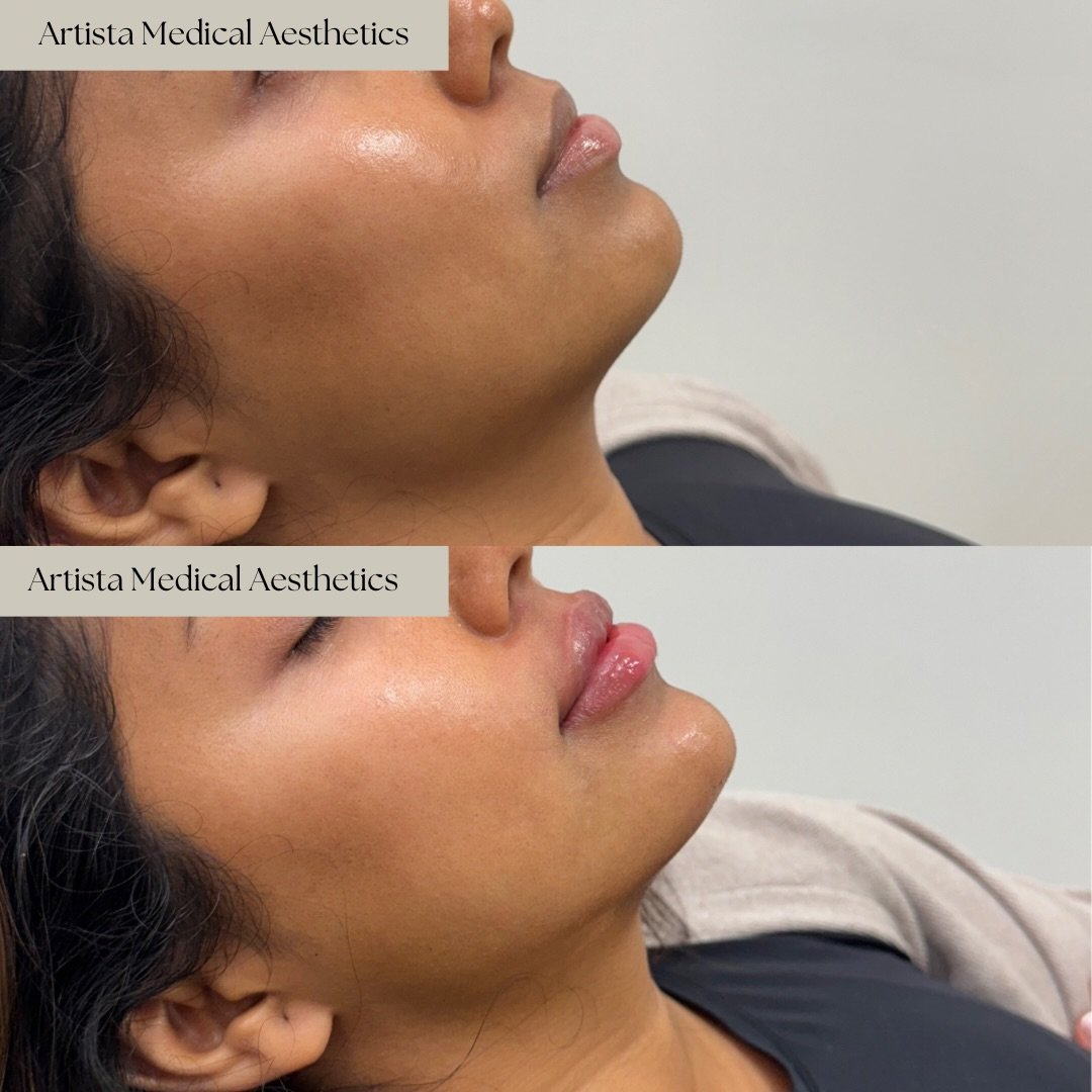 A4423EC7-018A-49D5-A017-E7DAE2F130D2