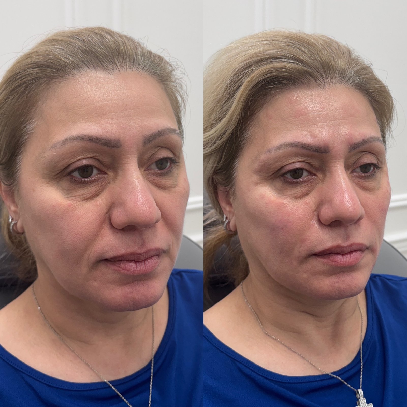 BF8F4440-7B2B-41E0-B8A4-DDAF458C3D9A